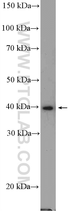 11279-1-AP;A549 cells