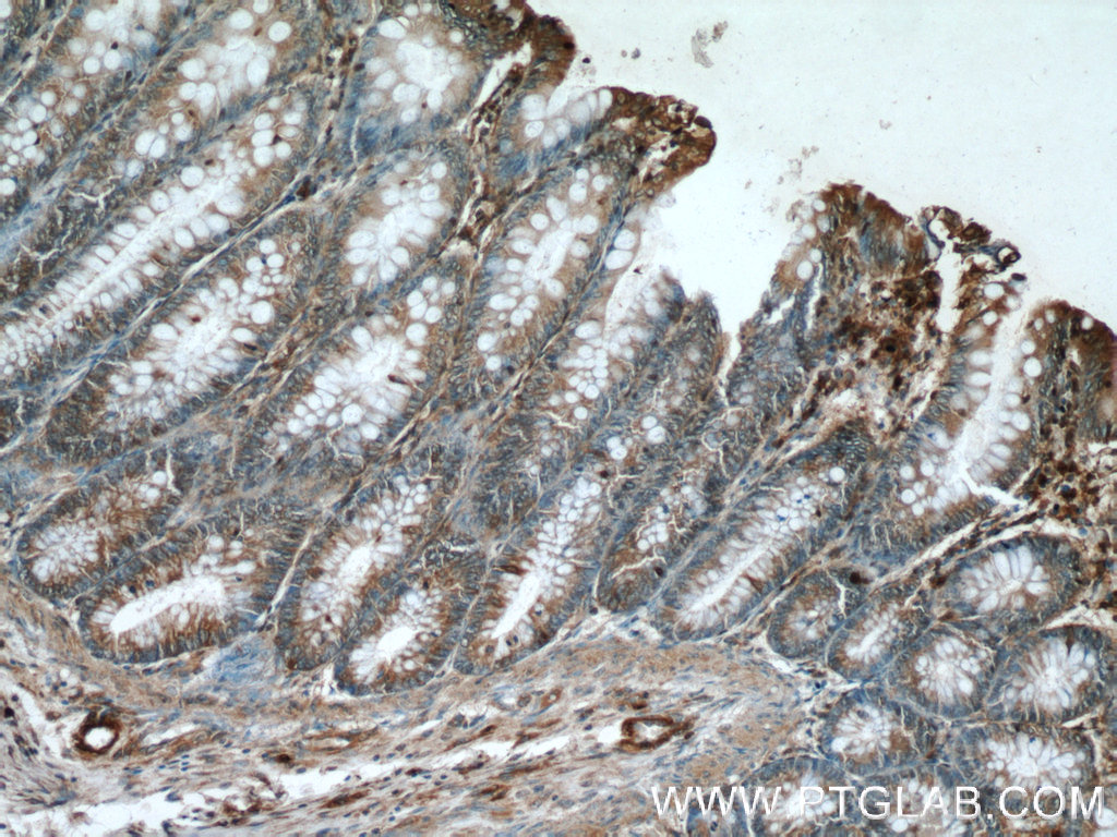 24906-1-AP;human colon tissue