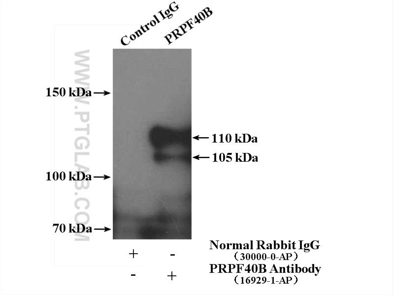 16929-1-AP;Y79 cells