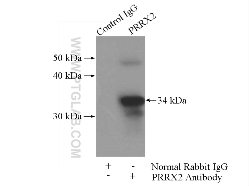 23869-1-AP;mouse brain tissue