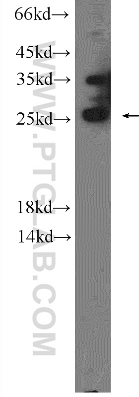 23869-1-AP;mouse brain tissue