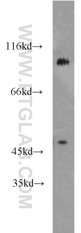 17404-1-AP;mouse brain tissue