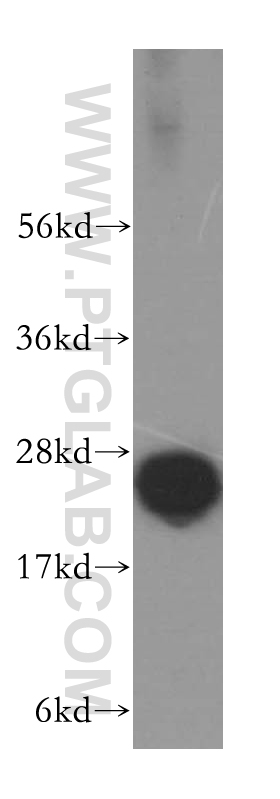 11684-2-AP;human brain tissue