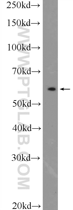 11196-1-AP;mouse brain tissue