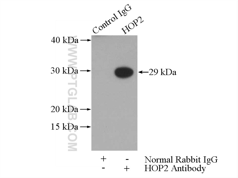 11339-1-AP;Jurkat cells