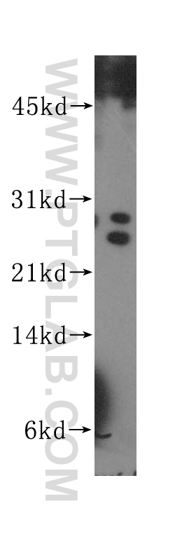 11339-1-AP;K-562 cells