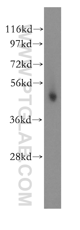 11389-1-AP;human skeletal muscle tissue