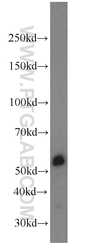 14899-1-AP;K-562 cells