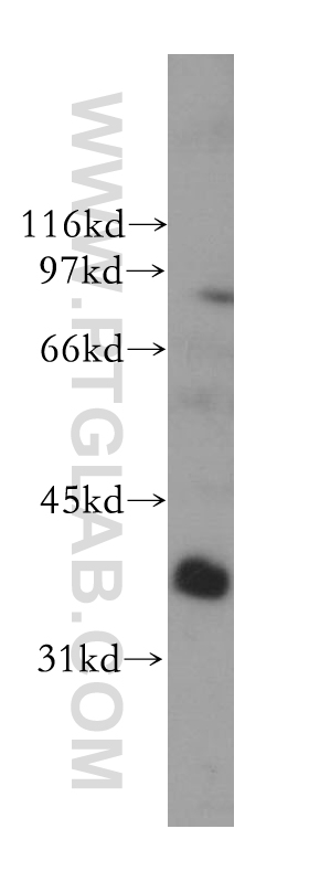 13374-1-AP;human liver tissue