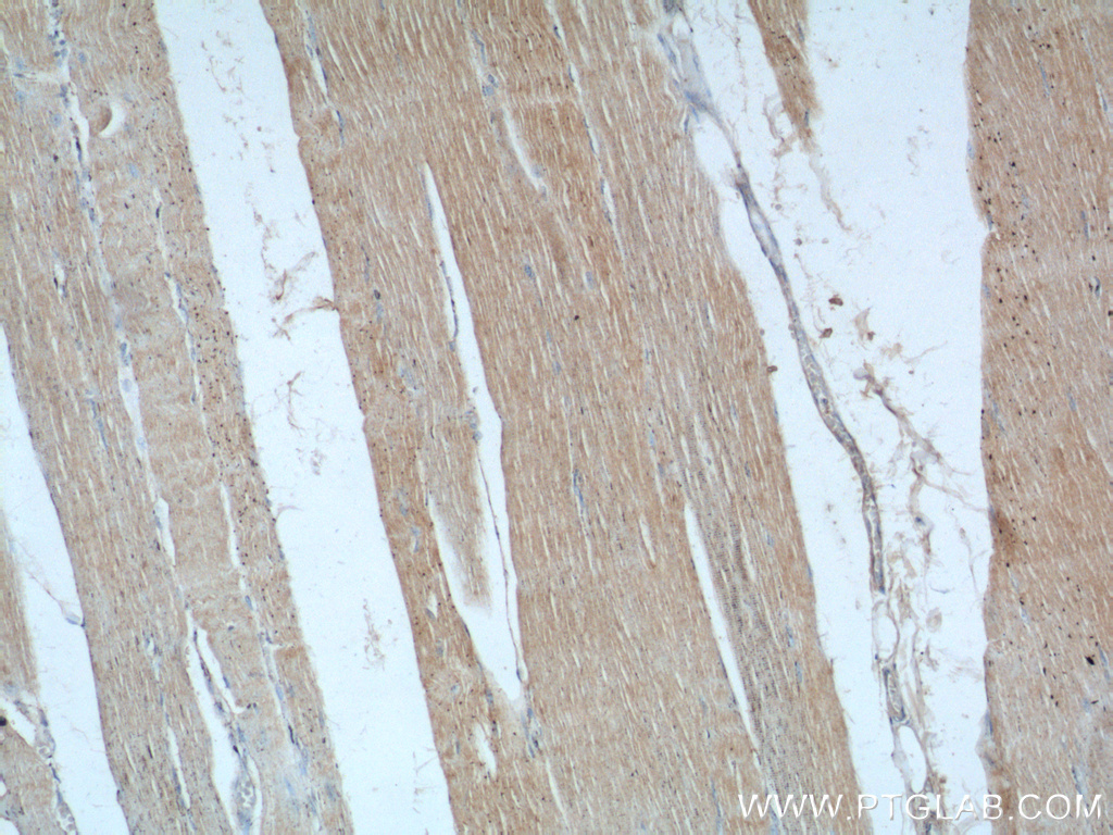 24570-1-AP;human skeletal muscle tissue