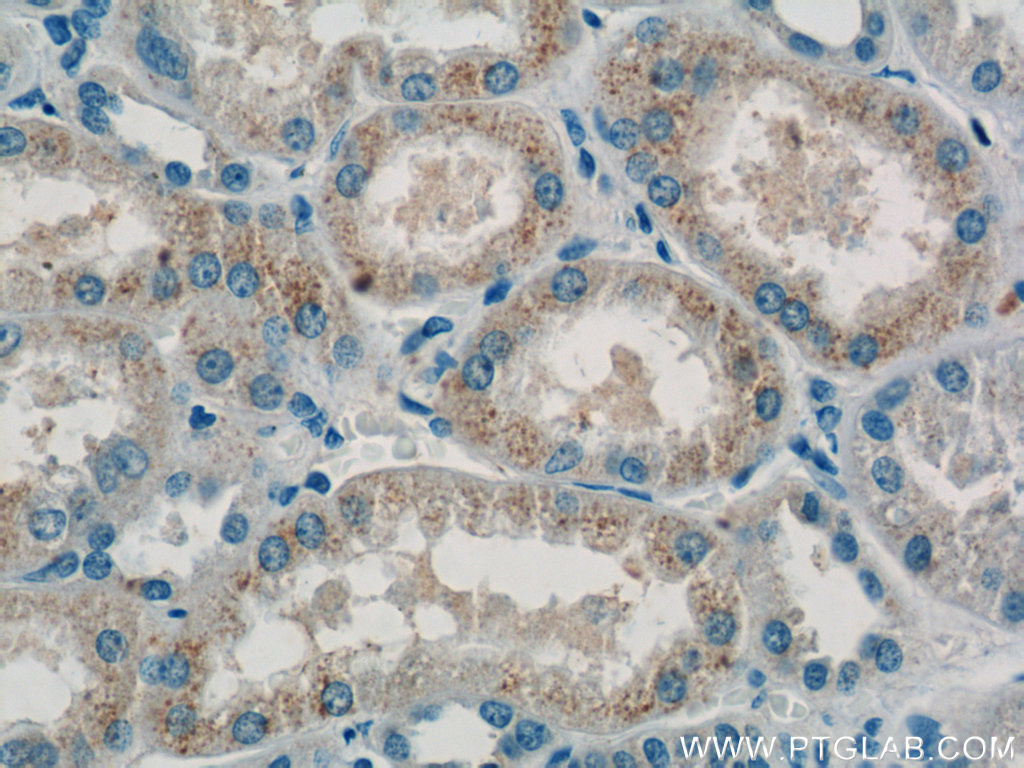 24801-1-AP;human kidney tissue