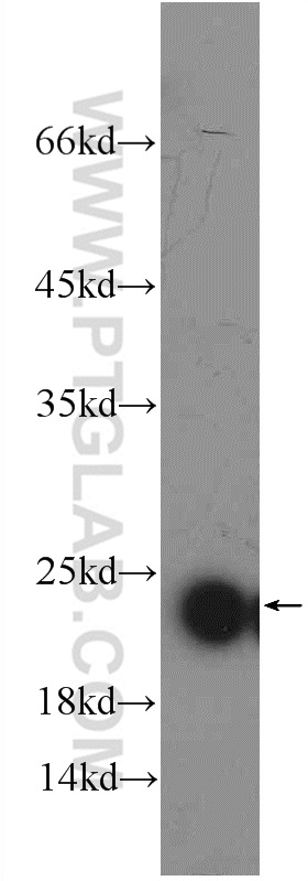 24801-1-AP;rat liver tissue