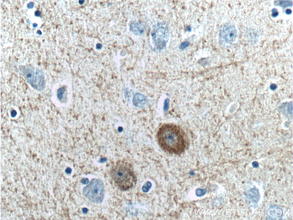 26521-1-AP;human brain tissue