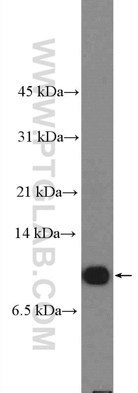 26521-1-AP;mouse brain tissue