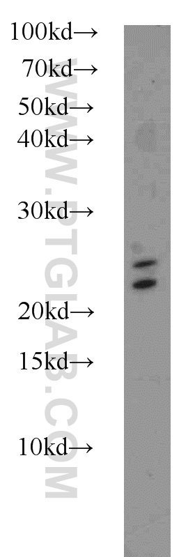 16865-1-AP;mouse brain tissue