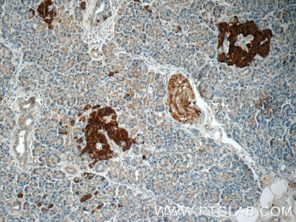 15774-1-AP;human pancreas tissue