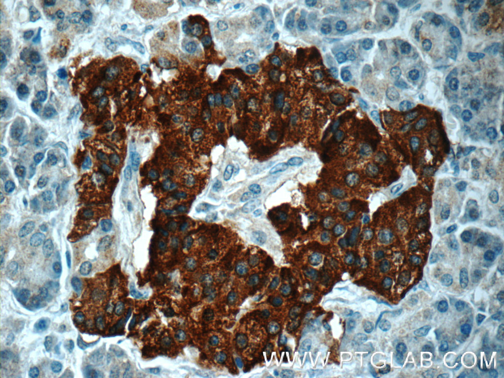 15774-1-AP;human pancreas tissue