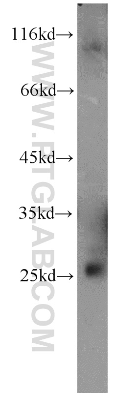 15774-1-AP;human brain tissue