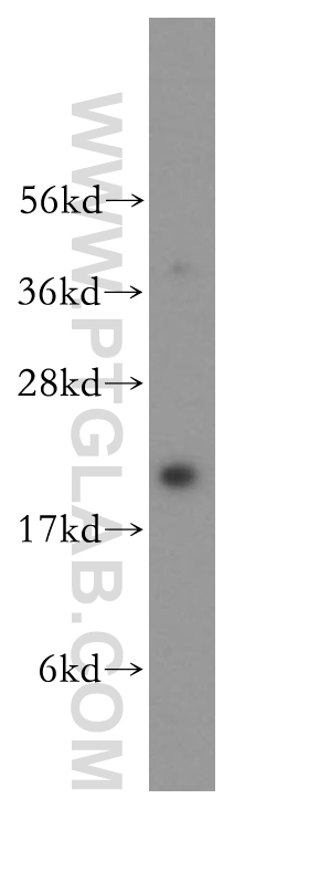 11420-1-AP;HeLa cells