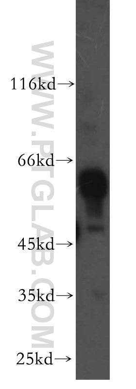 14448-1-AP;human brain tissue