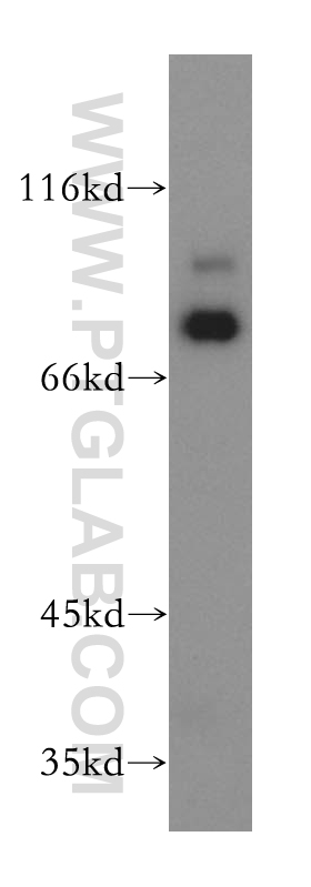 18333-1-AP;K-562 cells