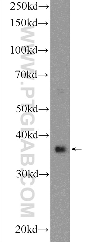 14961-1-AP;mouse testis tissue