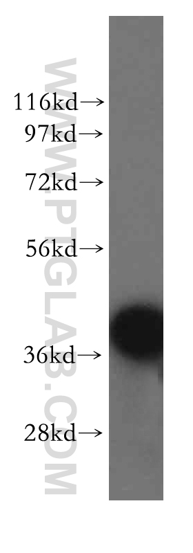 11255-1-AP;human brain tissue