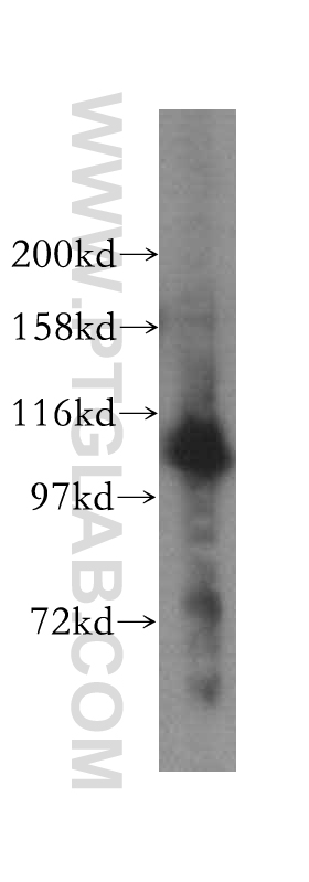 17507-1-AP;HeLa cell