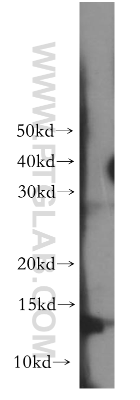 10327-1-AP;human heart tissue