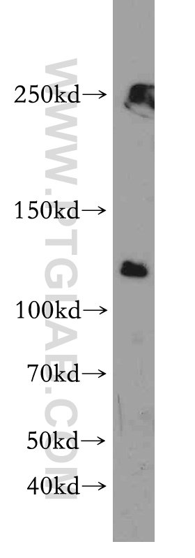 17656-1-AP;HEK-293 cell