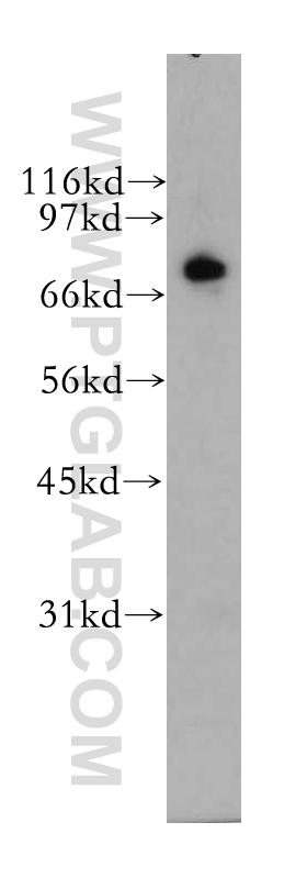 12556-1-AP;human brain tissue