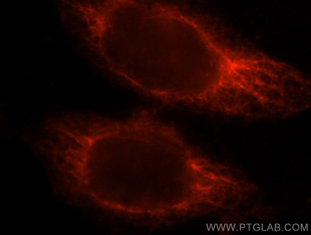 11921-1-AP;Hela cells