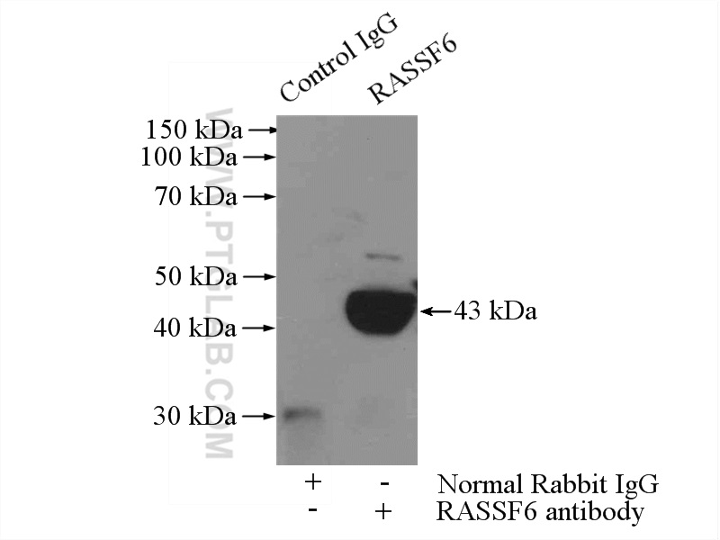 11921-1-AP;HepG2 cells