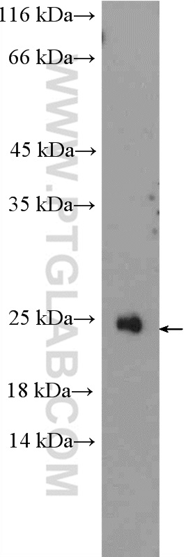 11466-1-AP;Jurkat cells