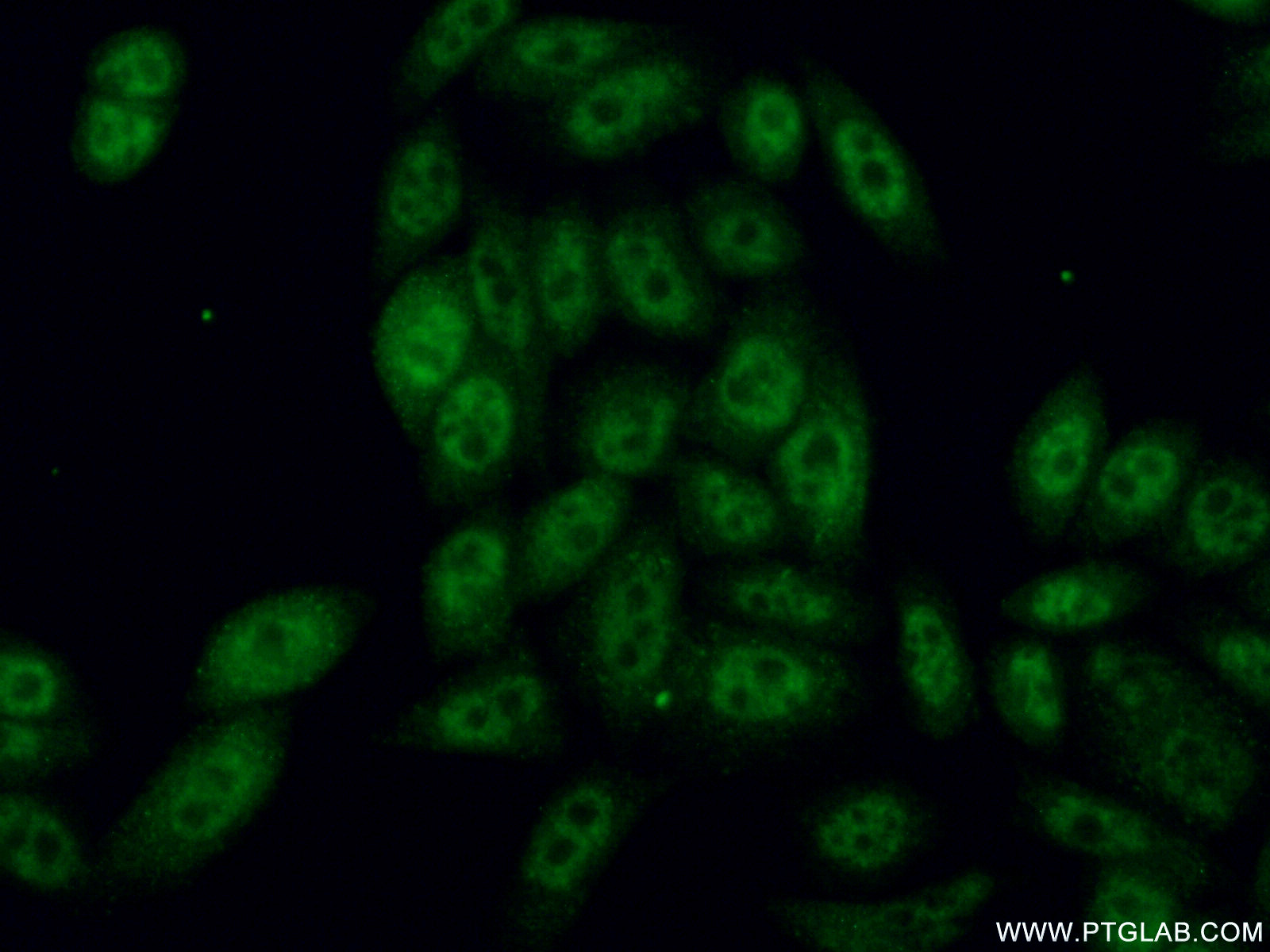 11882-1-AP;HeLa cells