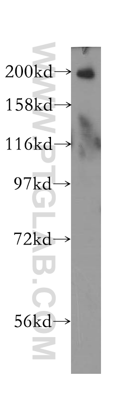 11882-1-AP;HEK-293 cells