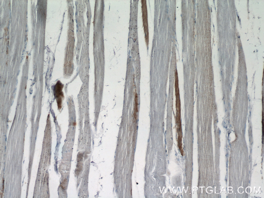 18178-1-AP;human skeletal muscle tissue