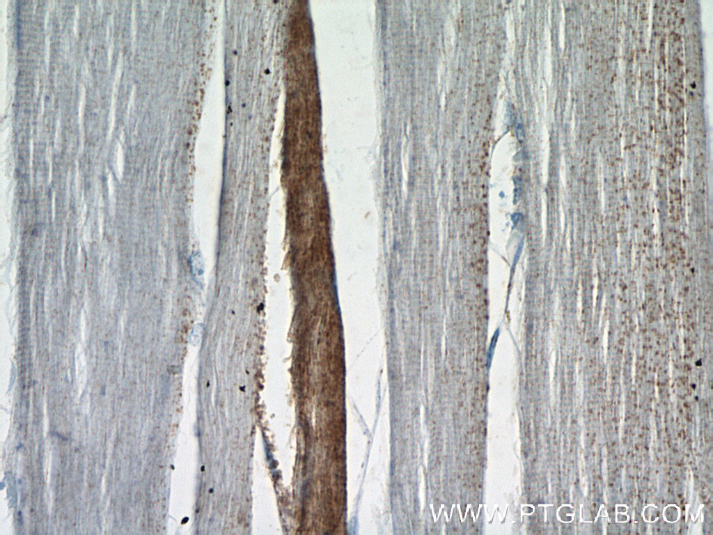 18178-1-AP;human skeletal muscle tissue