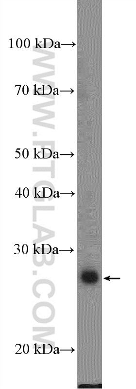 18178-1-AP;HeLa cells