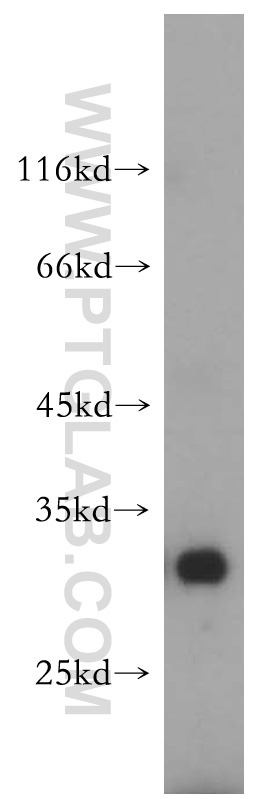 17994-1-AP;HepG2 cell