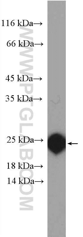 11774-1-AP;human plasma tissue