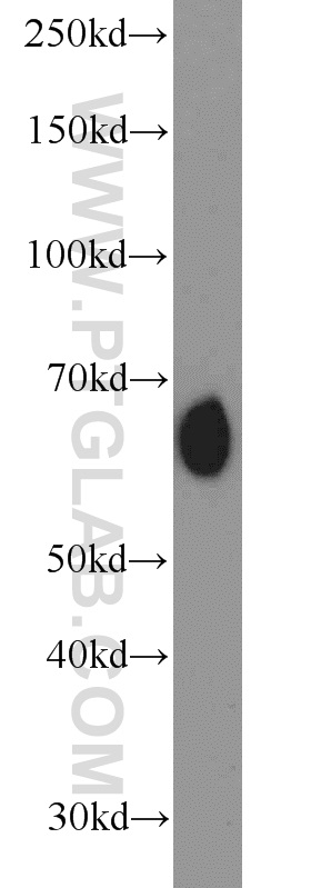 14613-1-AP;mouse kidney tissue