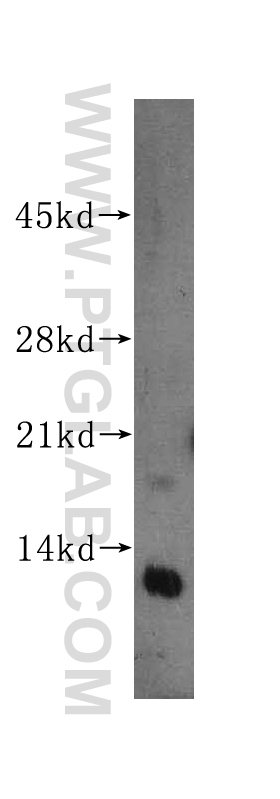 14895-1-AP;HeLa cell