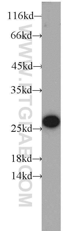 14869-1-AP;mouse brain tissue