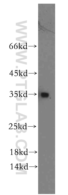 12900-1-AP;human brain tissue