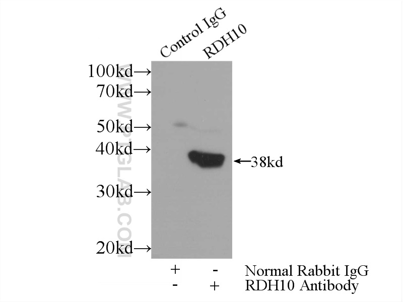 14644-1-AP;mouse liver tissue