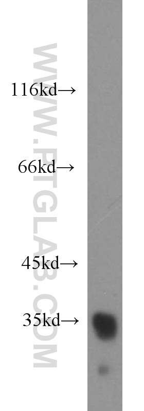 10638-1-AP;K-562 cells