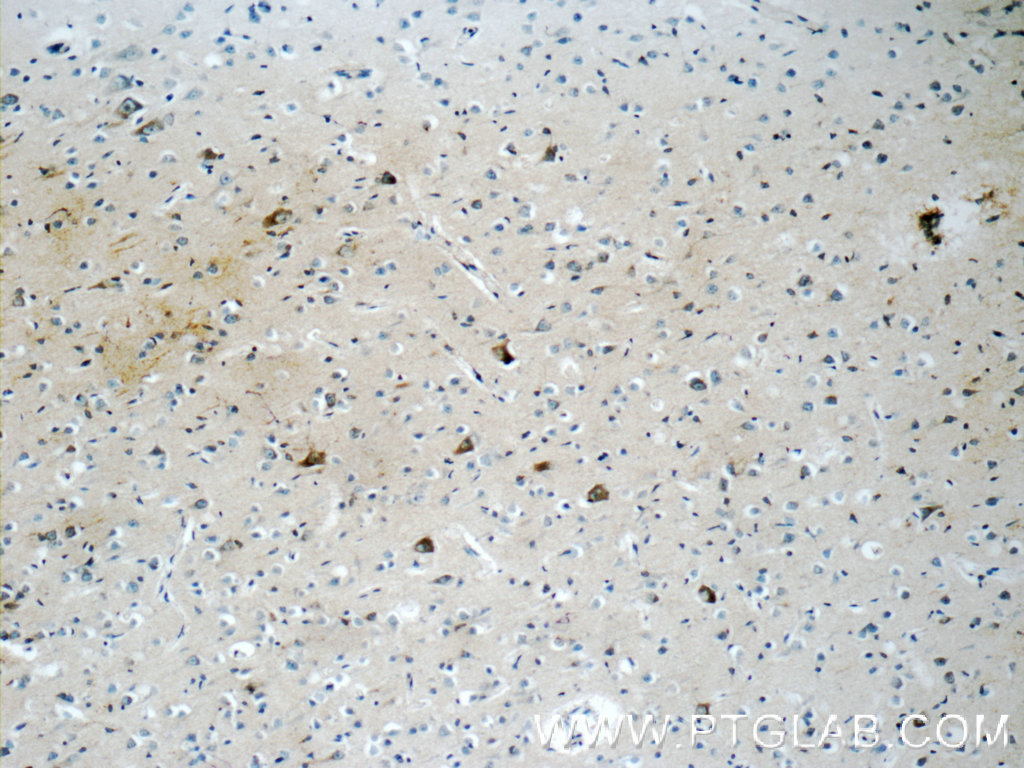 10687-1-AP;human brain tissue