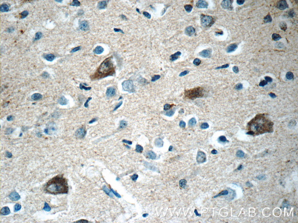 10687-1-AP;human brain tissue