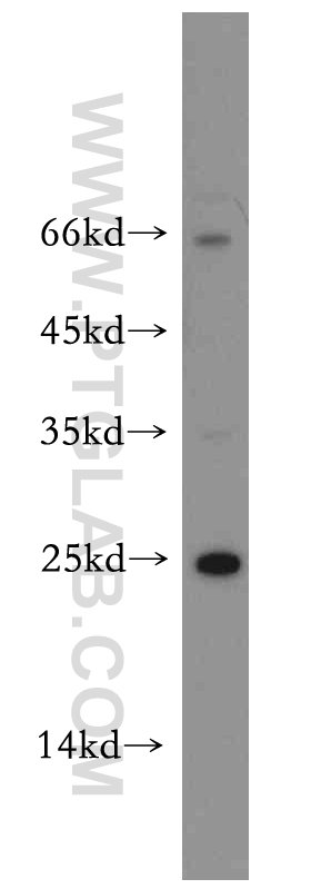 10687-1-AP;MCF7 cells